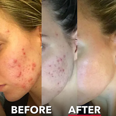 Time Reverse Cream